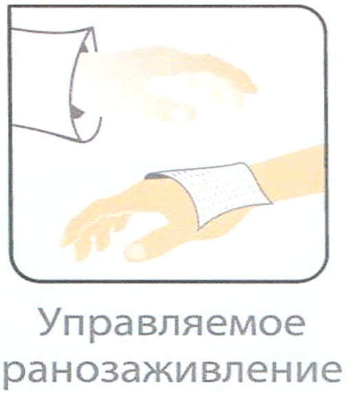 Управляемое ранозаживление